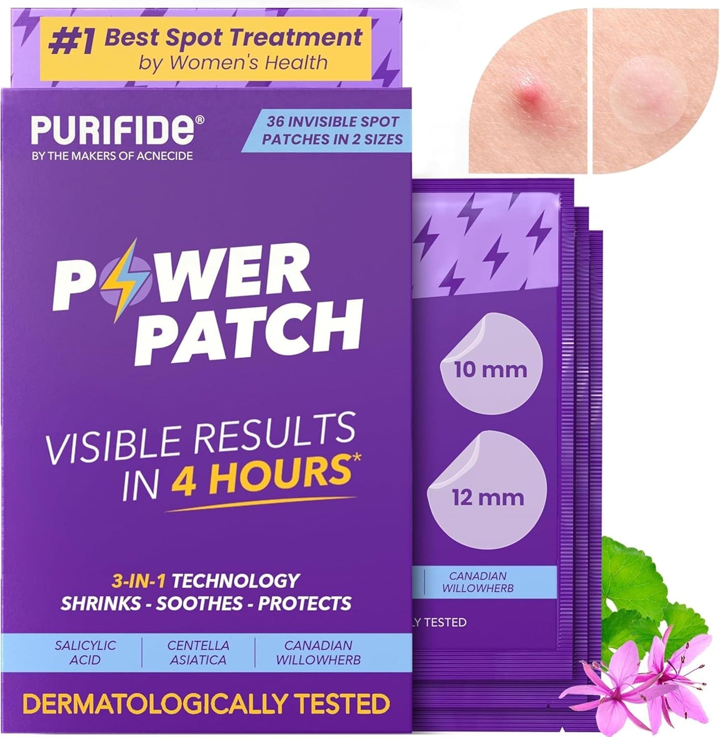 Purifide Power Patch spot treatment for acne with 36 invisible patches in 2 sizes for quick skin healing