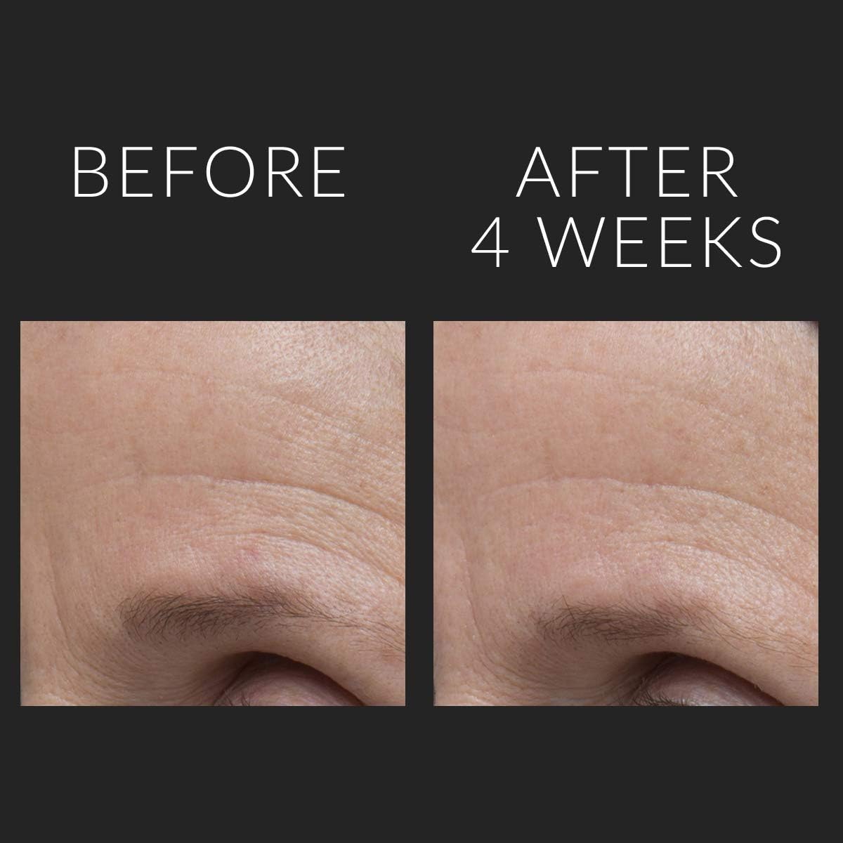 Kate Somerville DermalQuench Liquid Lift + Retinol Advanced Resurfacing Treatment 75ml
